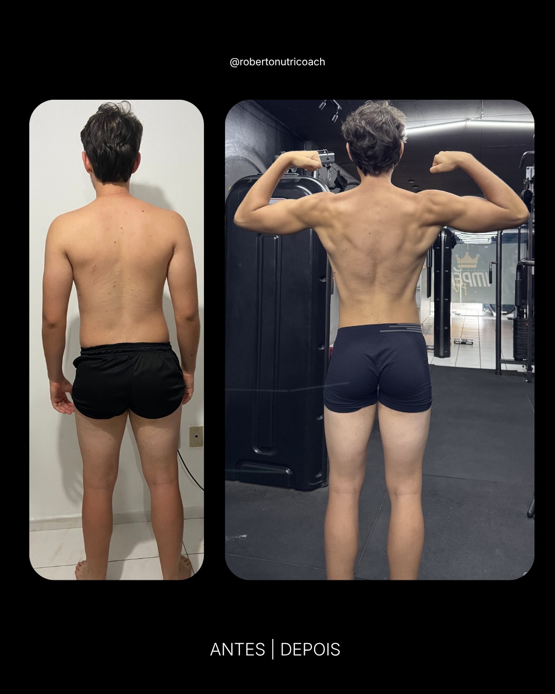 Paciente J.M. — Recomposição corporal