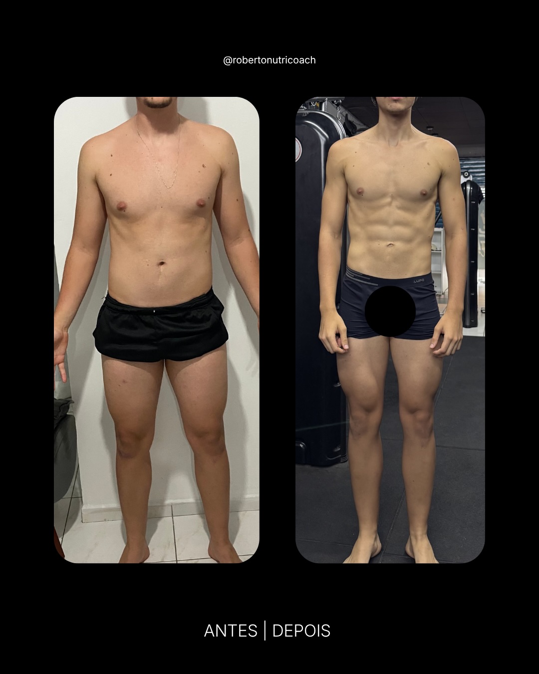 Paciente L.F. — Definição muscular
