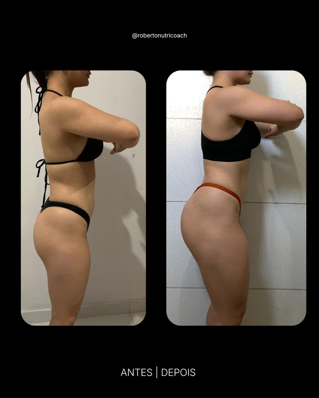 Paciente C.S. — Recomposição corporal
